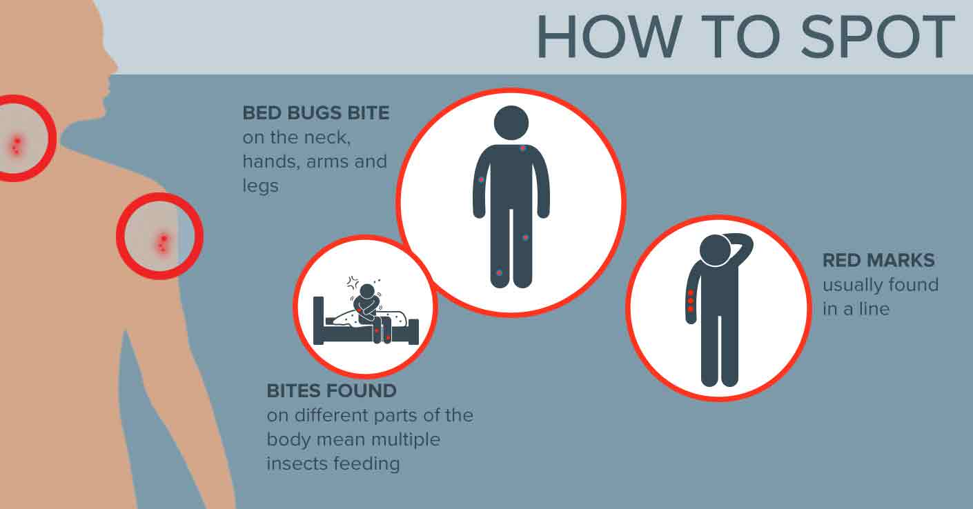 Hot To Spot Beg Bug Bites